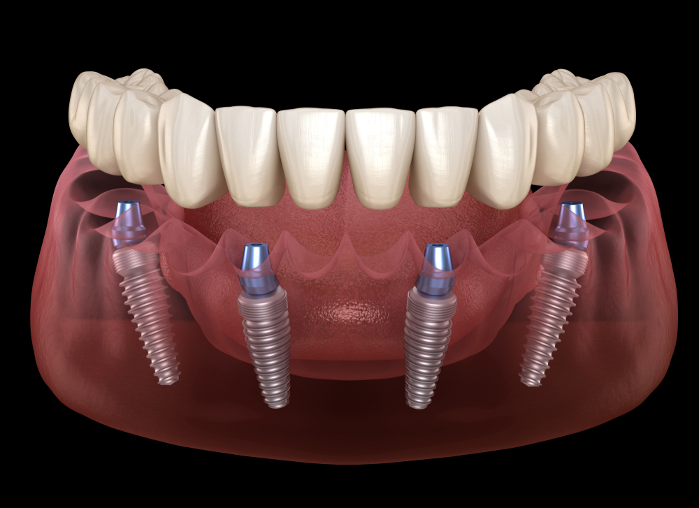 tribeca_dental_studio on Instagram
