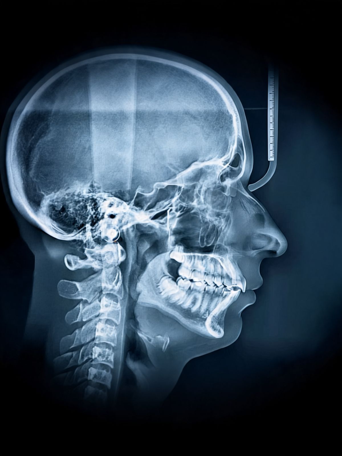 Airway Treatments & Airway Orthodontics Tribeca Dental Studio