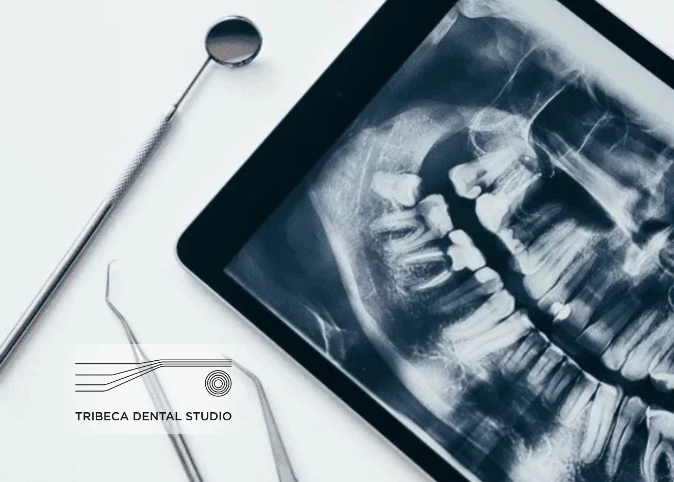 Gum Disease and Alzheimer’s