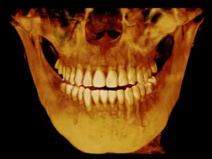 3D Imaging at Tribeca Dental Studio