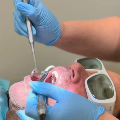 LANAP Laser Gum Therapy In NYC