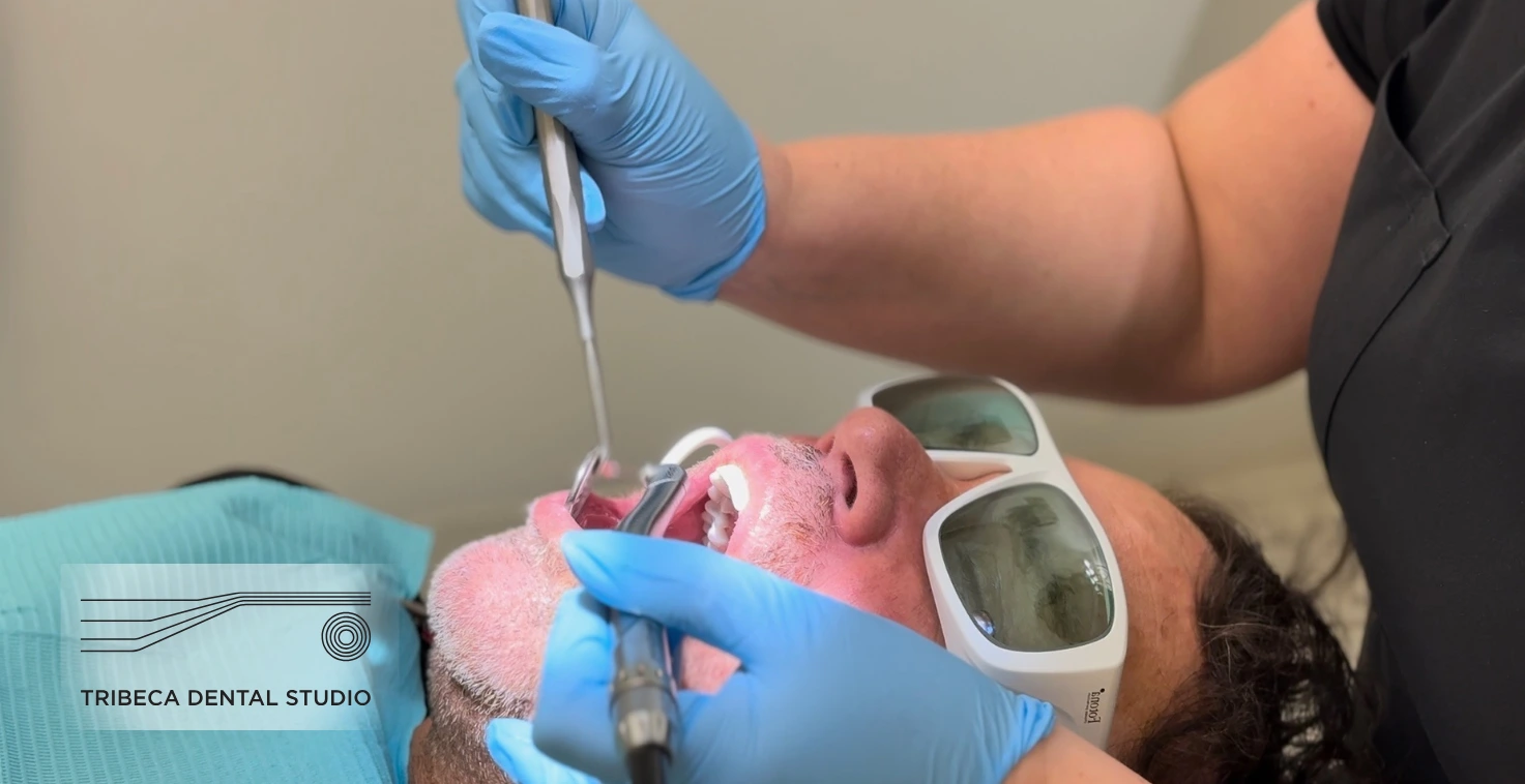 LANAP Laser Gum Therapy In Tribeca, NYC