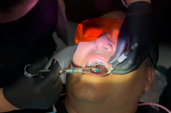 Airway orthodontics at Tribeca Dental Studio