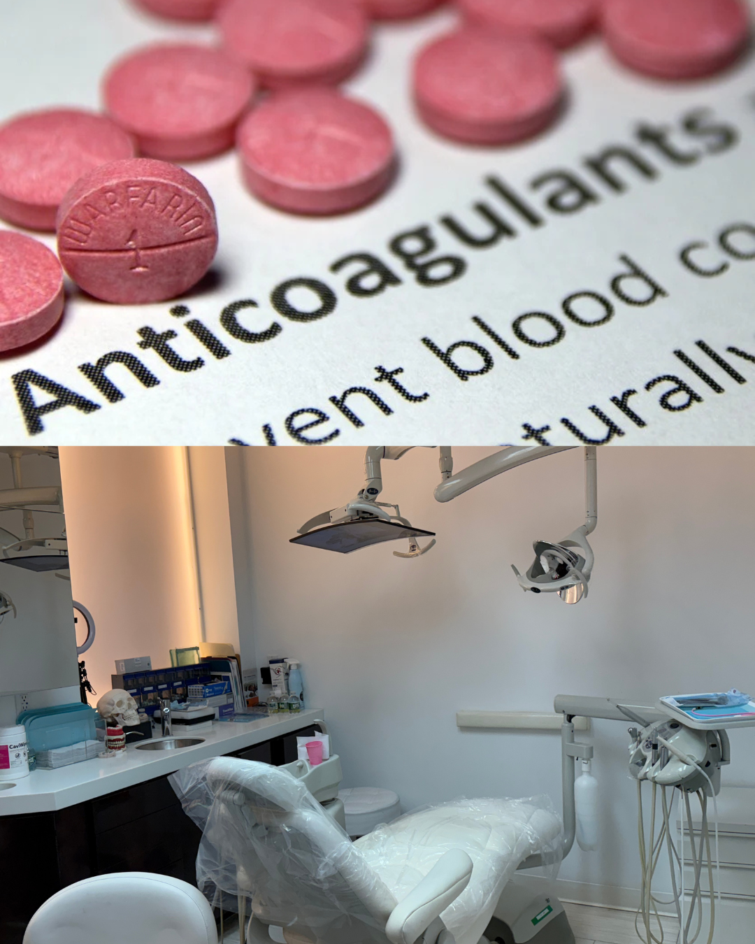 Dental Treatment on Anticoagulants at Tribeca Dental Studio