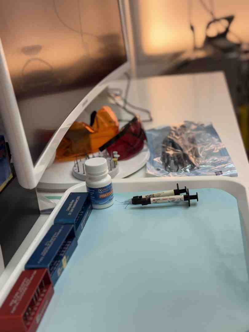 Composite filling cost