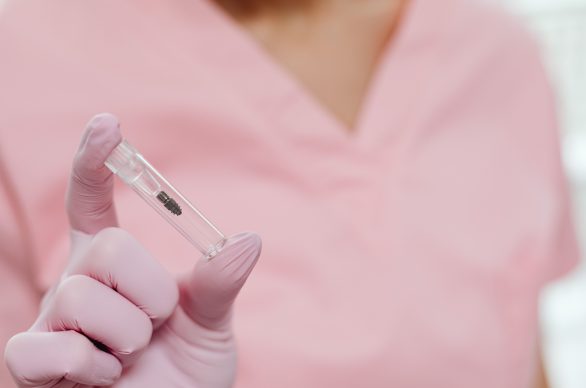 full arch dental implants new york ny